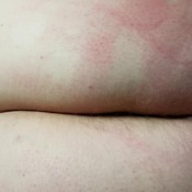 hairy asshole spreading and self spanking hd bbw quinn lane