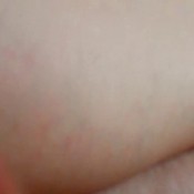 farting in a bottle hd nicoletta embassi