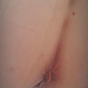 heidi foxx tummy trouble