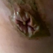 painful diarrhea hd The fart babes