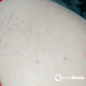 Anal_queen_mona Monna Shit And Pee Through Panties Over Carpet. Suck Shitty Toe. Dirty Atm. Lie Down On Shit. Red Flo Skitnik