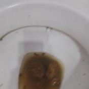 Amydirty Weekly Diarrhea