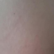 Jenniromero A Lot Of Diarrhea Jenni Romero