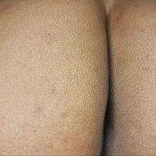 Goldenlace Worship My Smelly Anus