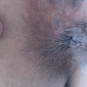 Goldenlace Ugly Ass Spread And Extreme Close Up