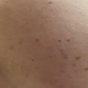 Freckledred_ Plugged Up