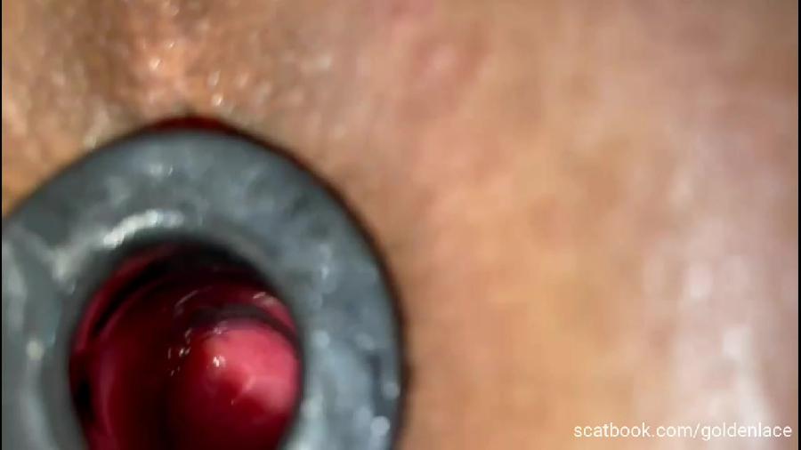 Goldenlace Dilator In My Ass Golden Lace